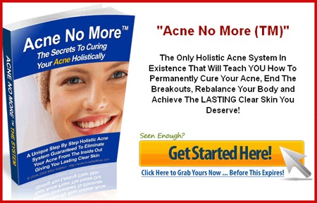 acne-no-more